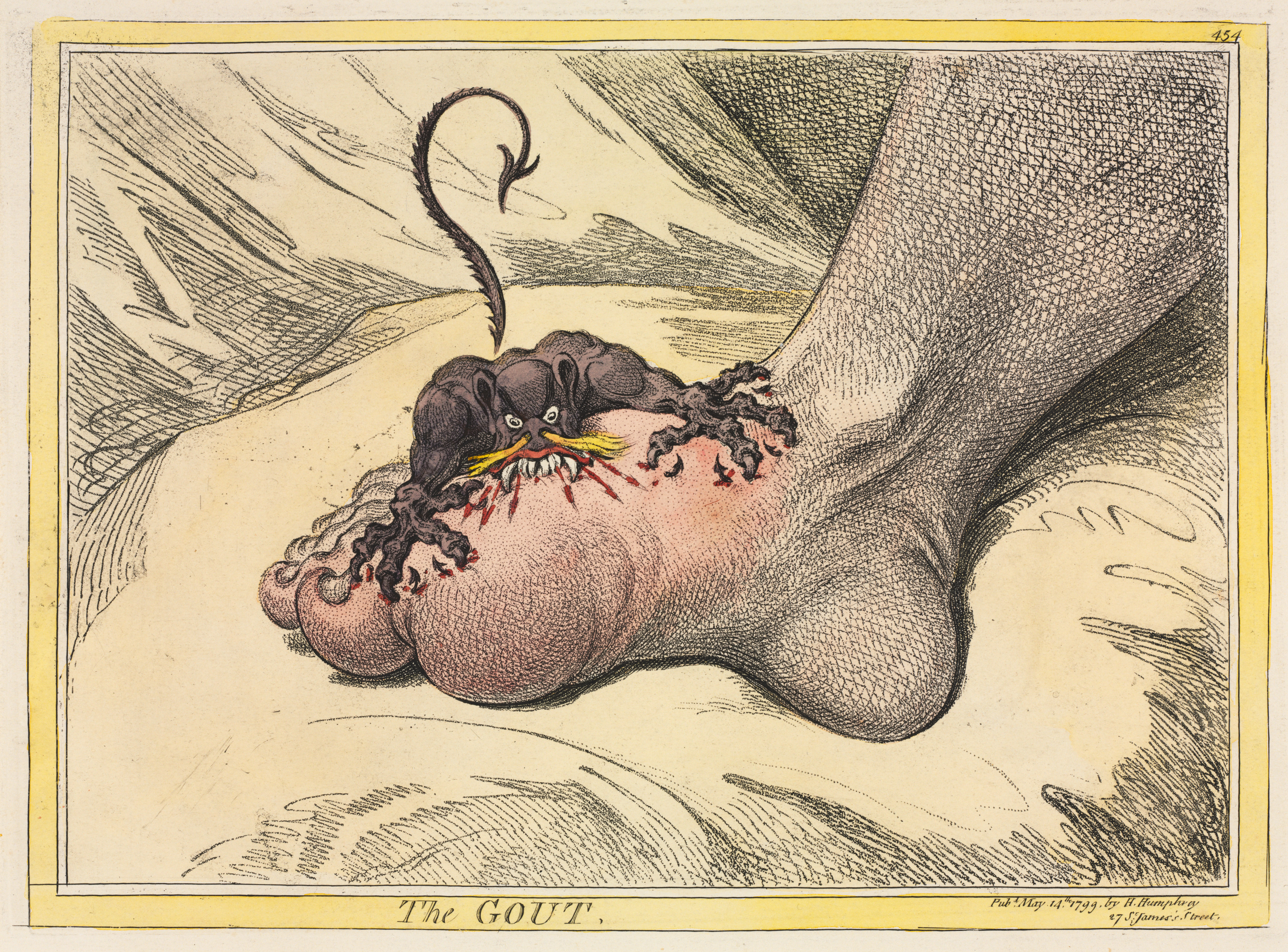 The Gout